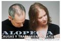 Alopecia en Mujeres Causas y Tratamiento Natural